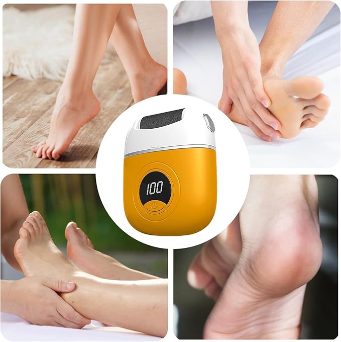 BlitzPro™ Electric Callus Remover