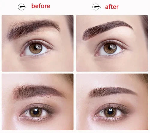 Eyebrow Epilator Image 3