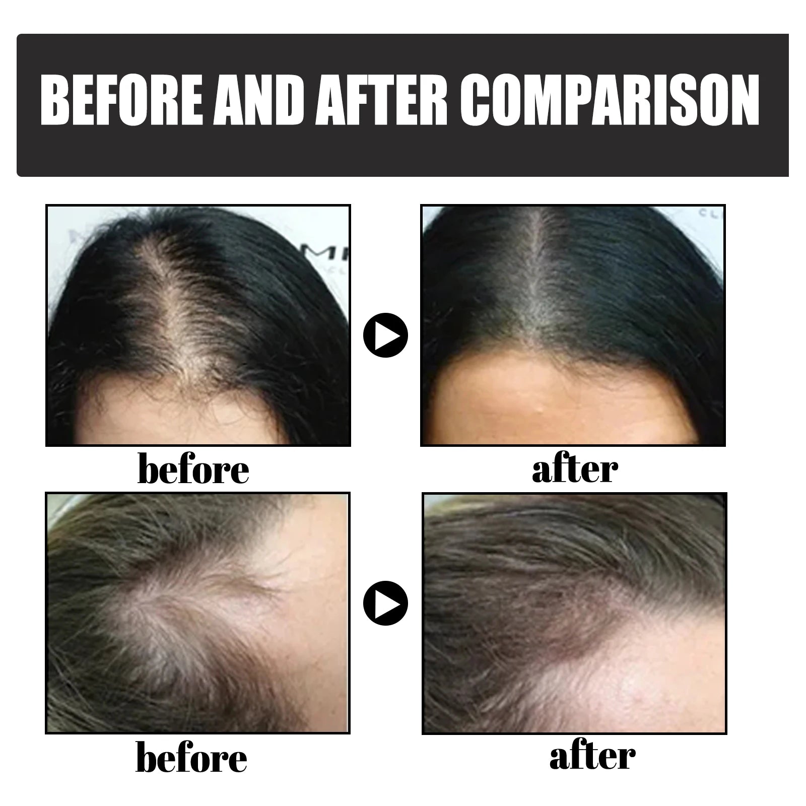 Hair Building Fibers Powder
